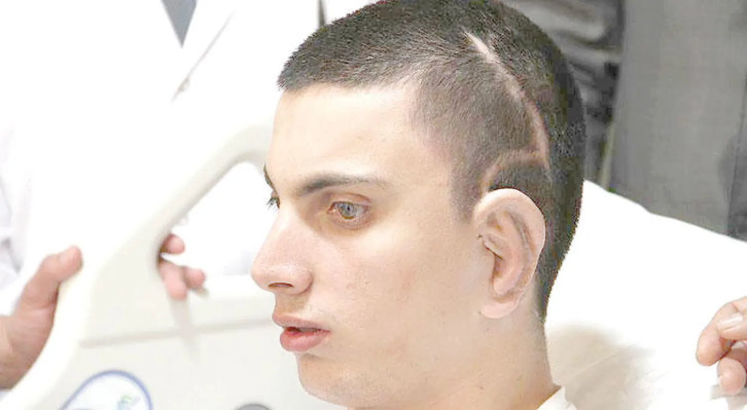 تركيا تسجل نجاح أول عملية في العالم لزراعة الأذن