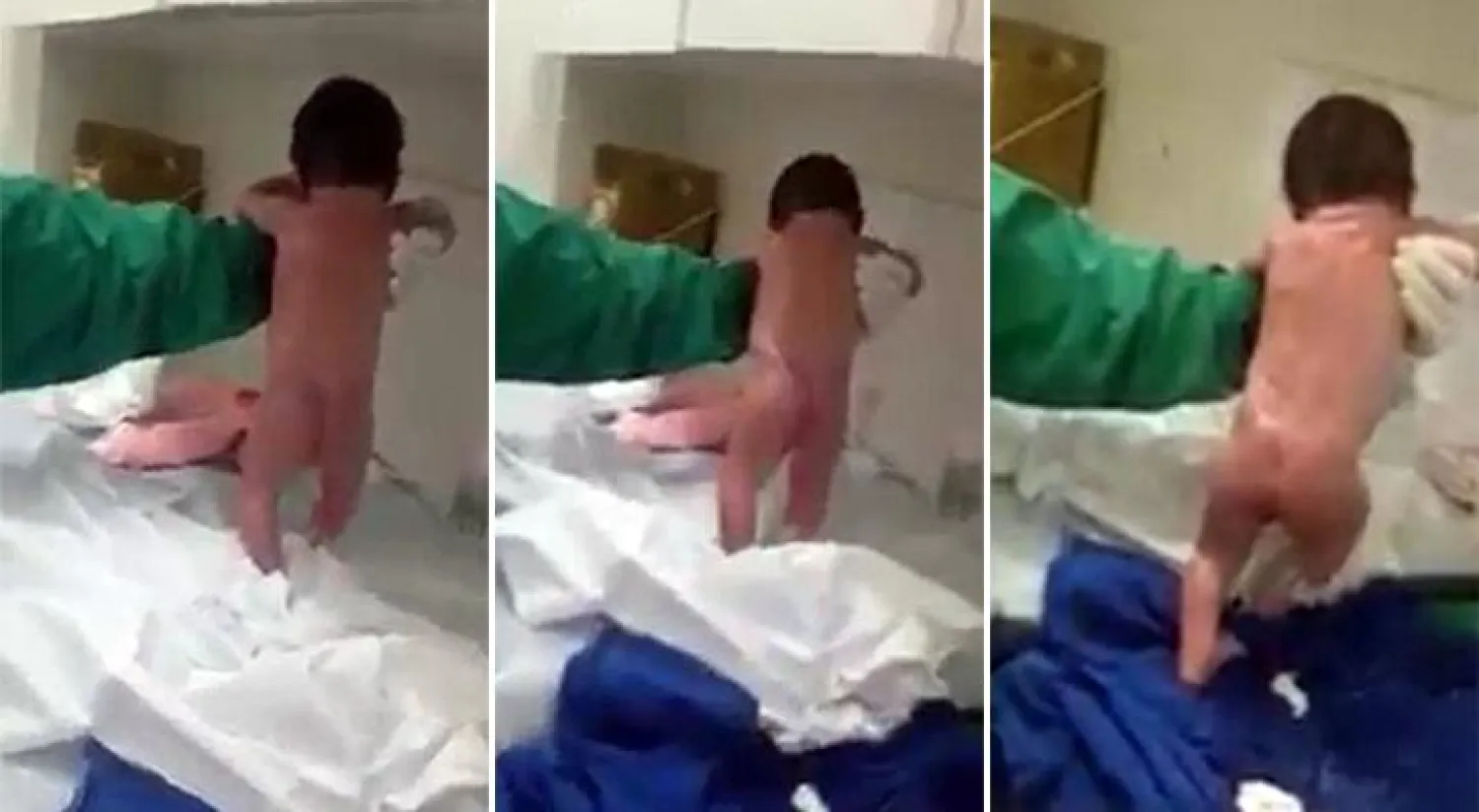 الطفلة مشت ما يقارب العشر خطوات بعد دقائق من ولادتها