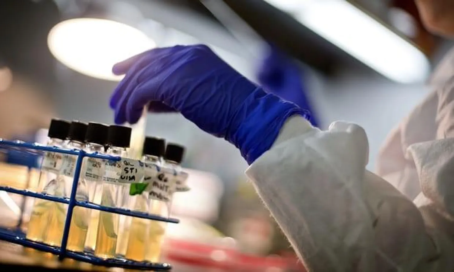 مادة تريكلوسان يمكن أن تتسبب في تكون بكتريا مستعصية على المضادات الحيوية (الغارديان)