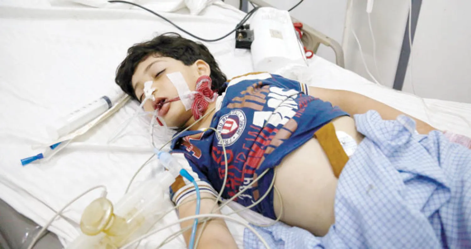 صورة لطفل تبين الوضع الصحي المتدهور في الغوطة الشرقية ({الشرق الأوسط})