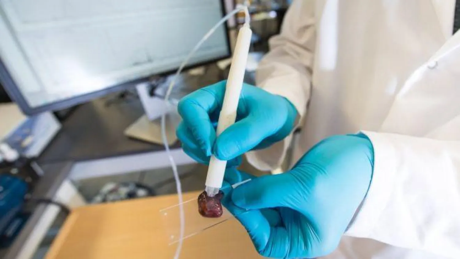 القلم الذي يتمكن من معرفة الخلايا السرطانية في 10 ثوانٍ (بي بي سي)