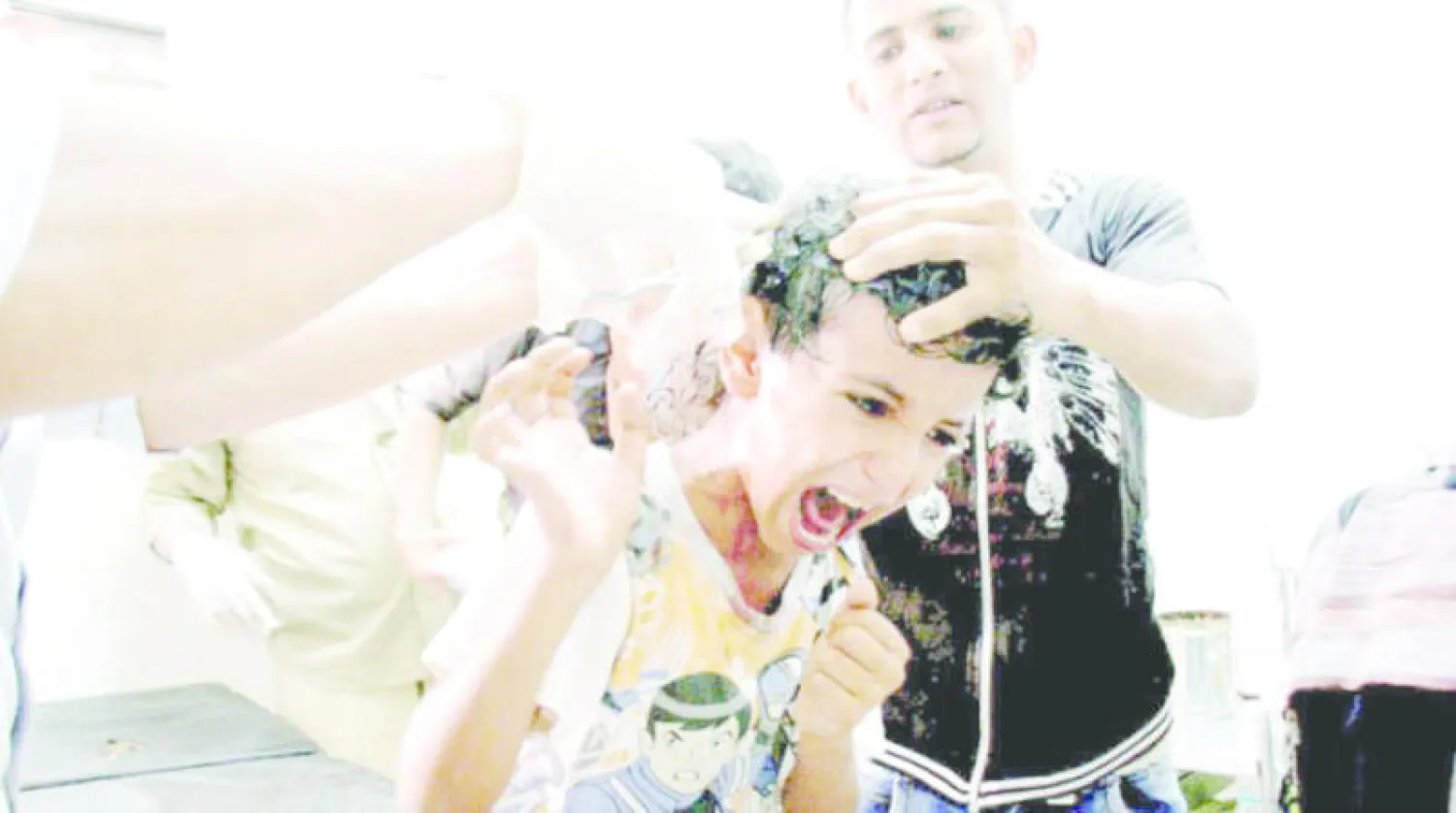 القصف العشوائي من قبل الانقلابيين أدى إلى إصابة كثير من الأطفال والمدنيين في تعز (رويترز)