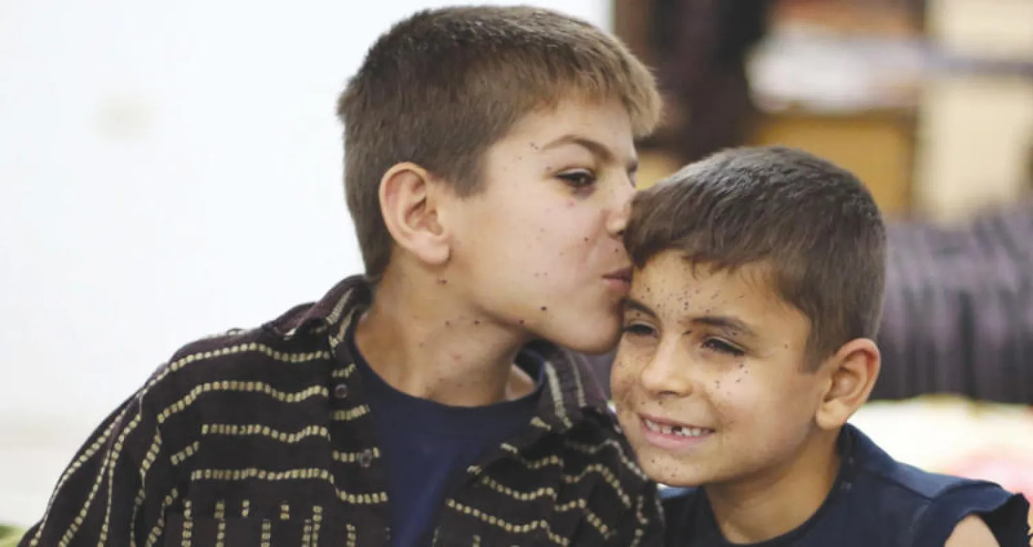 صبيان في مستشفى بعد اصابتهما إثر غارة على ريف دمشق (أ.ف.ب)