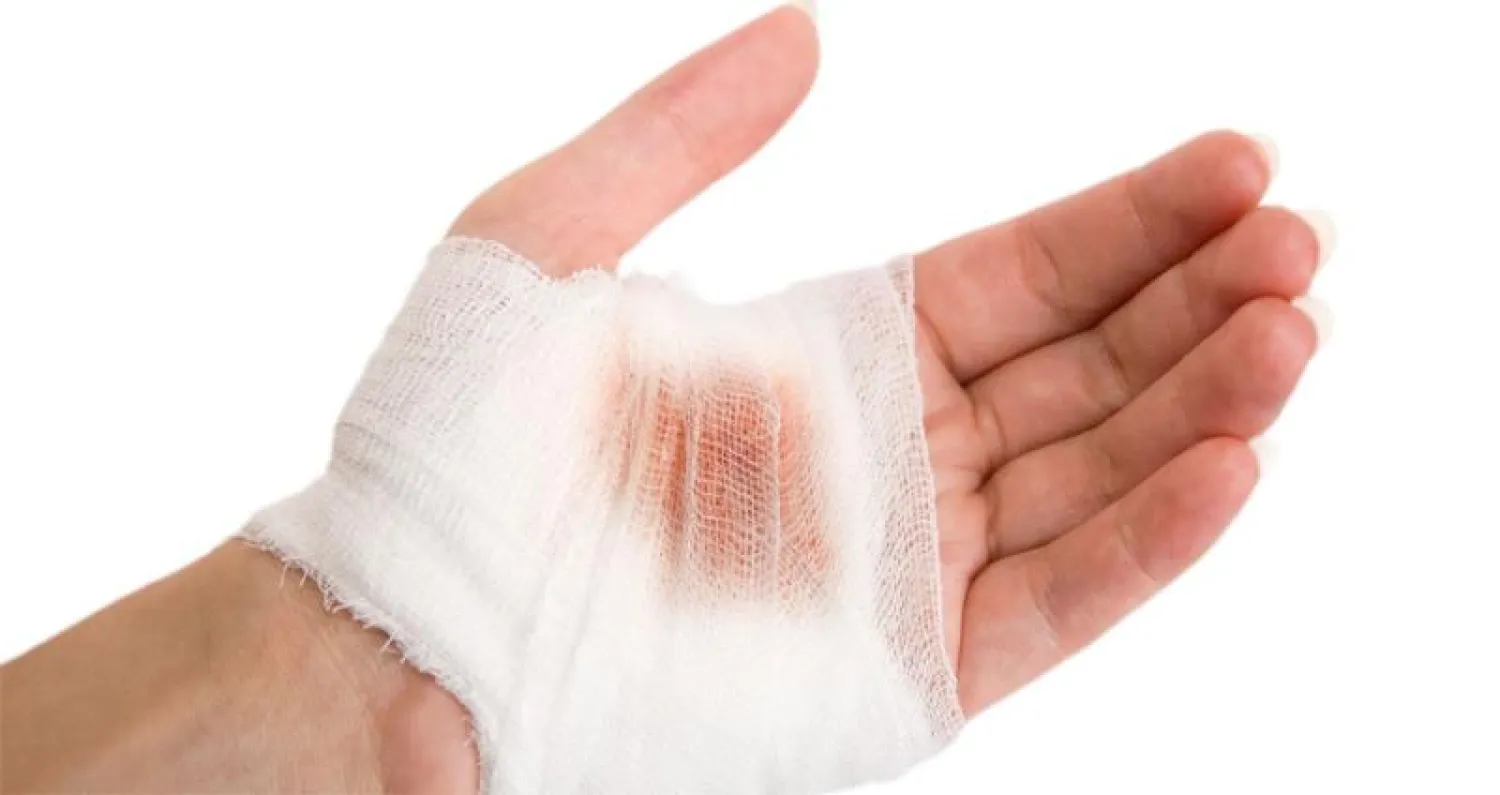 الساعة البيولوجية للجسم تتسبب في إبطاء شفاء الجروح في حال حدوثها ليلاً - أرشيف («الشرق الأوسط»)