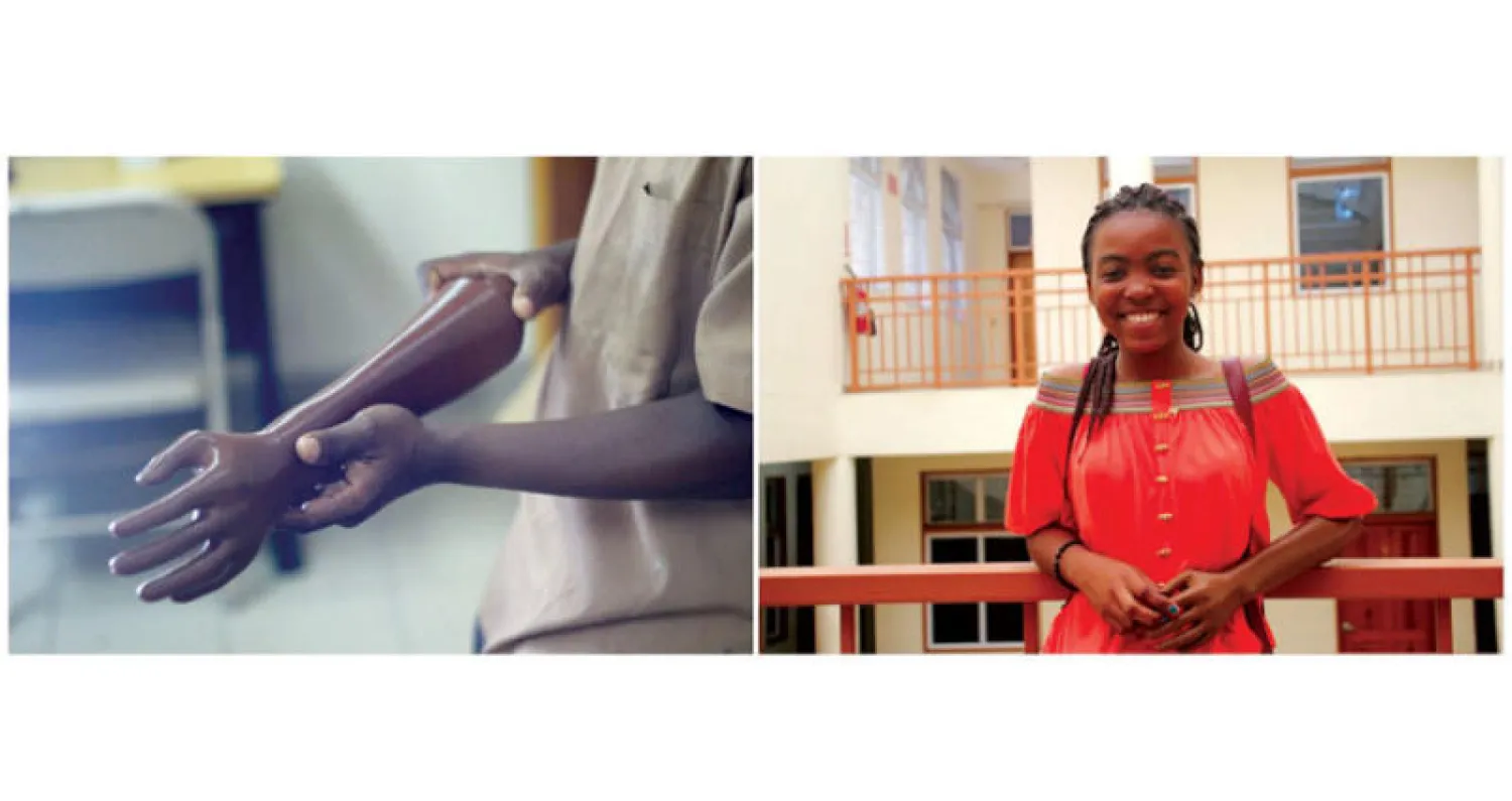 تسهم تقنيات التصاميم الحديثة في طباعة الأطراف البديلة بتكلفة منخفضة