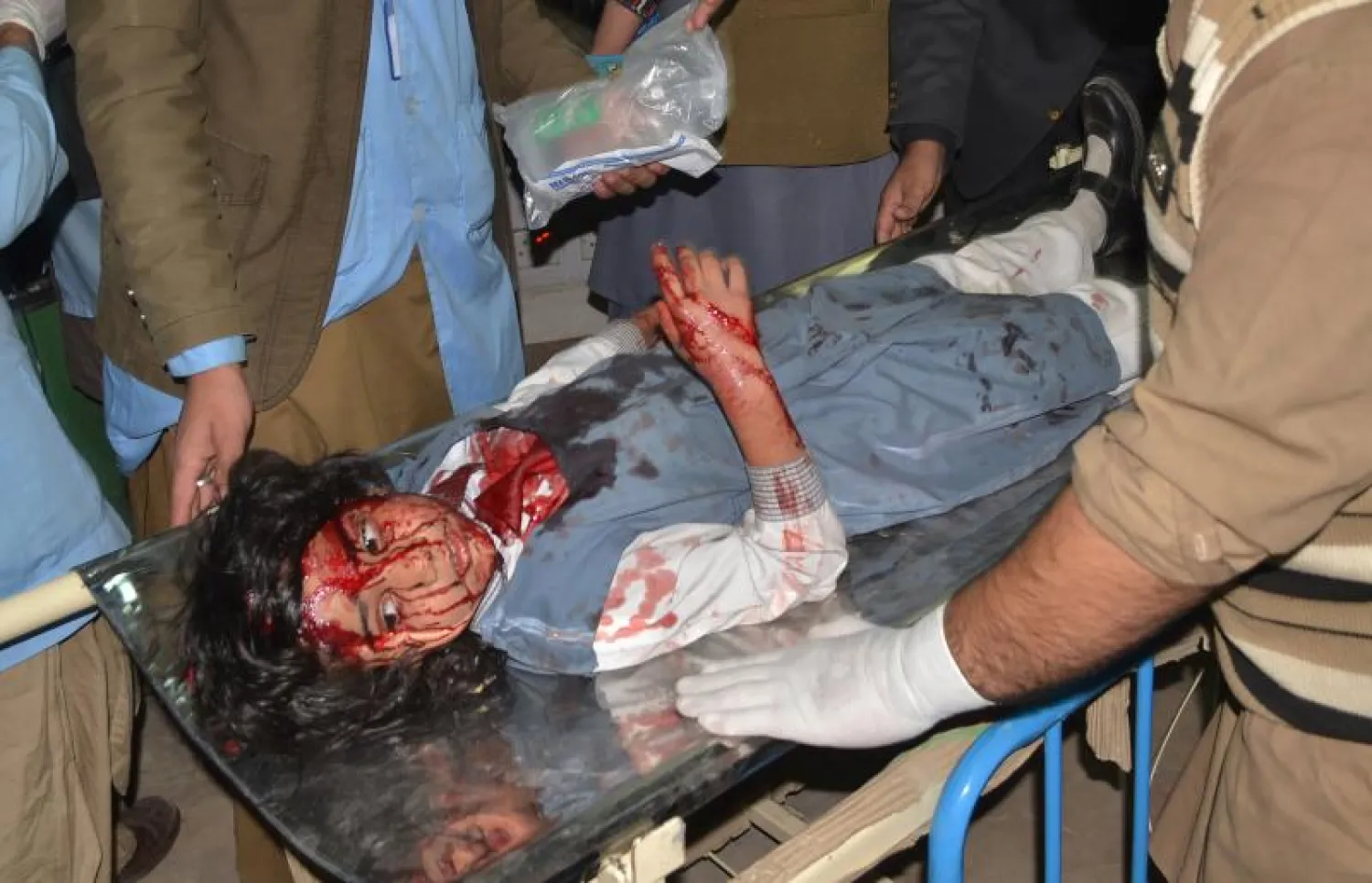 فتاة باكستانية أصيبت بجروح في التفجير الانتحاري وتتلقى العلاج بمستشفى كويتا (أ.ف.ب)