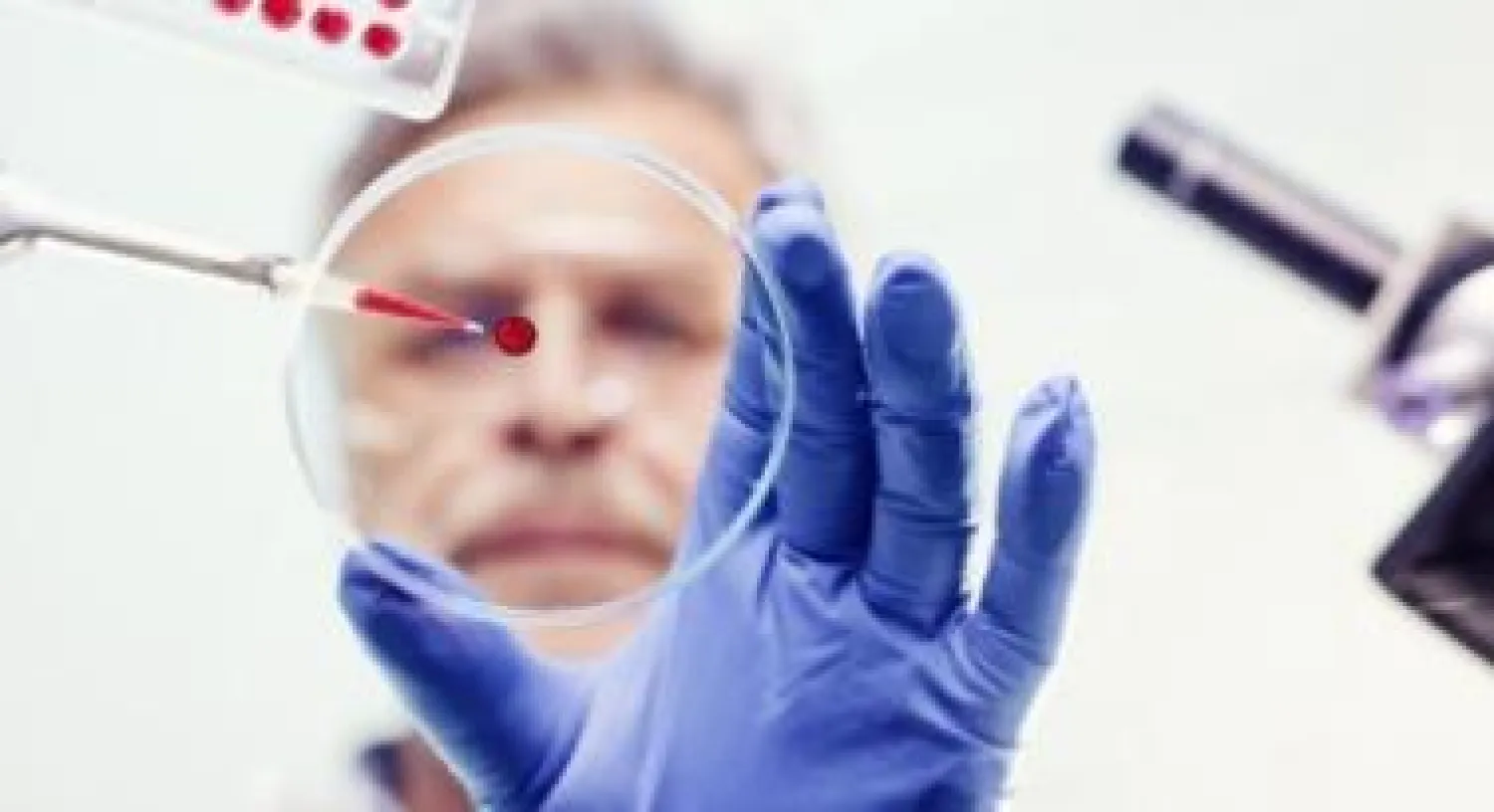 مخاطر إصابة الرجال بالتهاب في جدار القولون من الممكن أن يتراجع بأسلوب حياة صحي (ميديكال نيوز توداي)