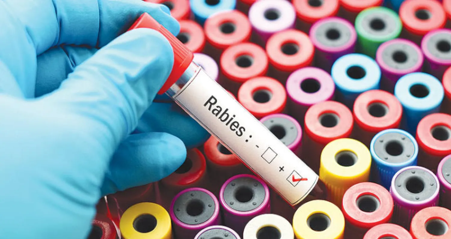 السُعار... مرض فيروسي ذو عواقب وخيمة