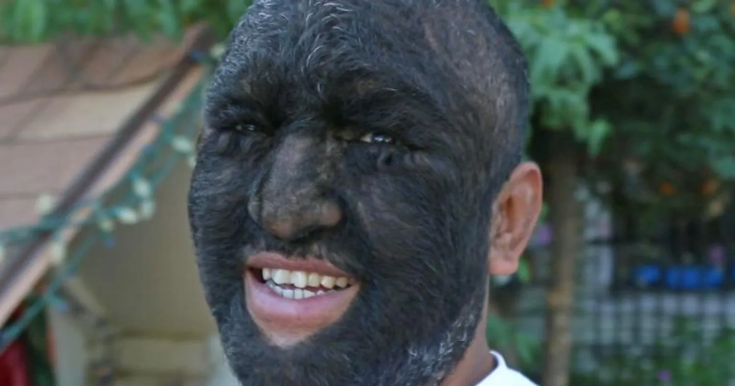 الرجل الذئب (ديلي ميل)