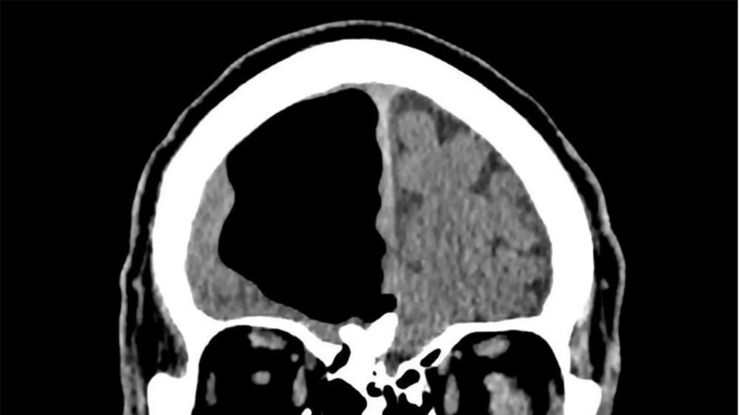 (BMJ Case Reports)