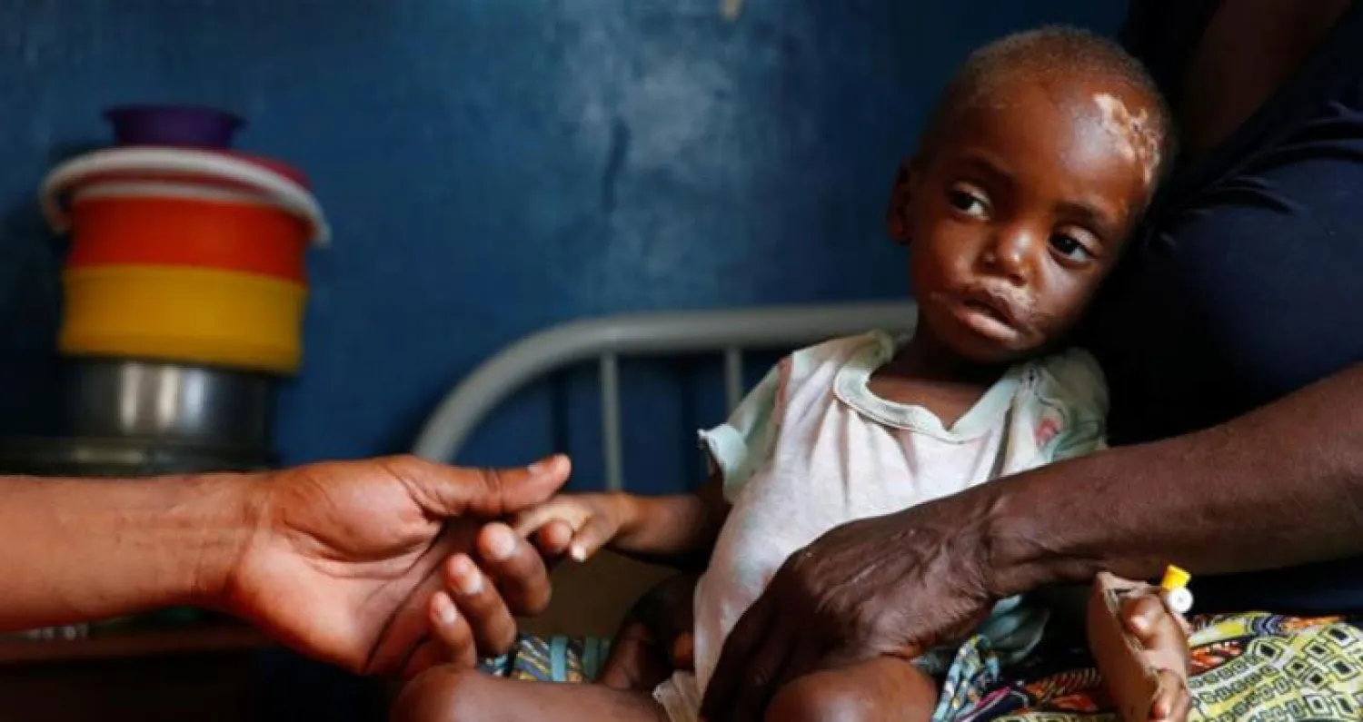 400 ألف طفل مهددون بالموت بسبب سوء التغذية في الكونغو