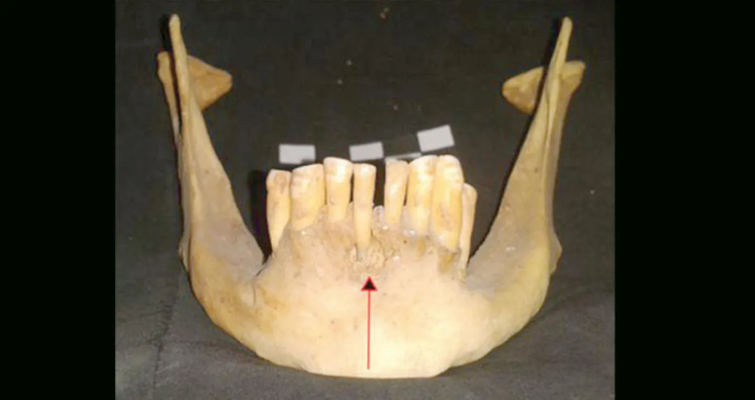 عينات أسنان الفك التي تعود لمومياوات فراعنة صحراء مصر الغربية