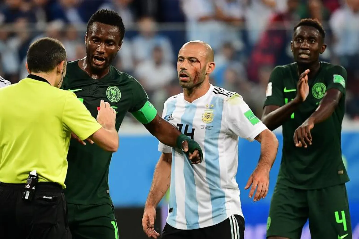 ماسكيرانو أصيب بجرح قطعي في الوجه خلال المباراة وسالت دمائه على أرض الملعب (أ.ف.ب)