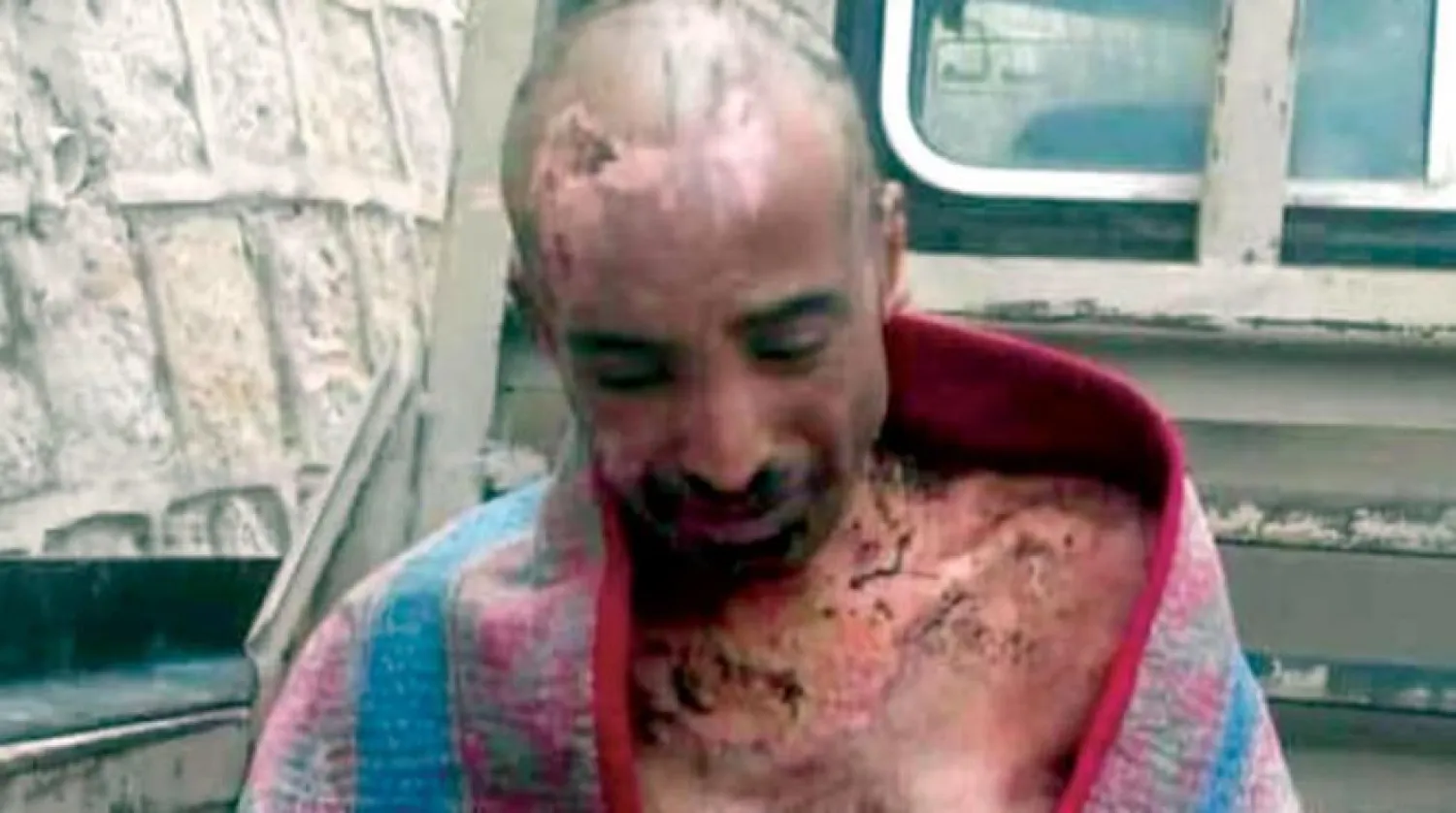 Dr. Mounir al-Sharqi after his release, Yemeni social media 
