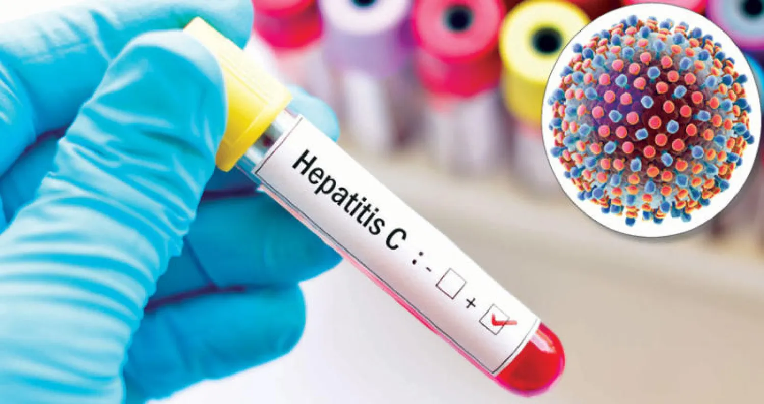 التهاب الكبد الفيروسي... مخاطر ومحاذير