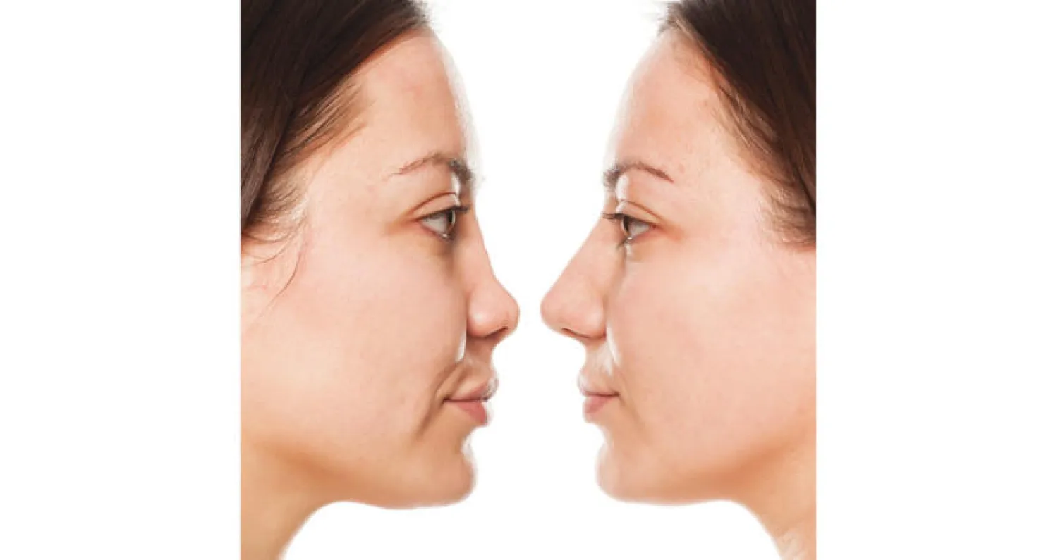 عمليات التجميل على «يوتيوب»... معلومات مشوشة