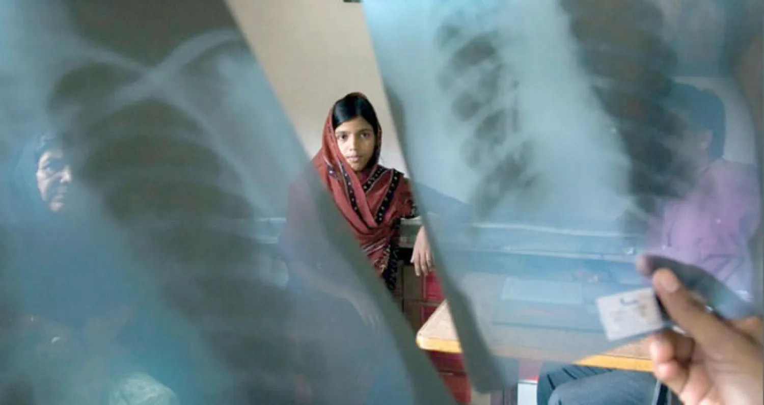 يستلزم المرض في بعض الأحيان تناول أدوية متعددة لأكثر من 6 أشهر