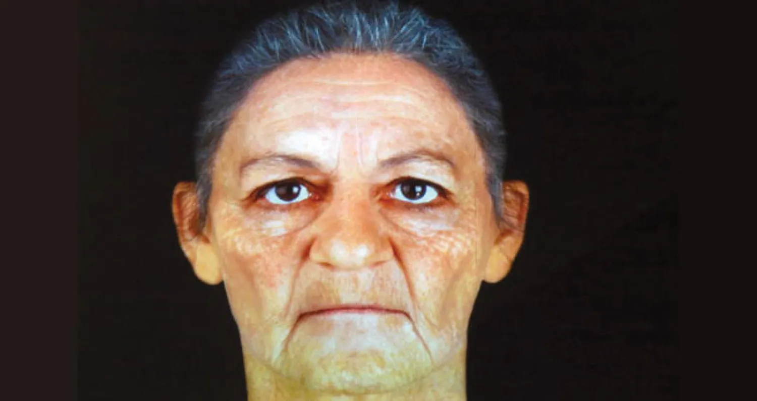 وجه المومياء كما كشفته الأشعة