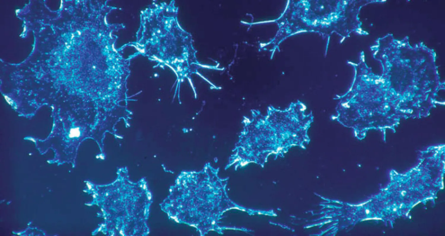 تجربة أميركية تحوّل الأورام إلى لقاح يواجه السرطان