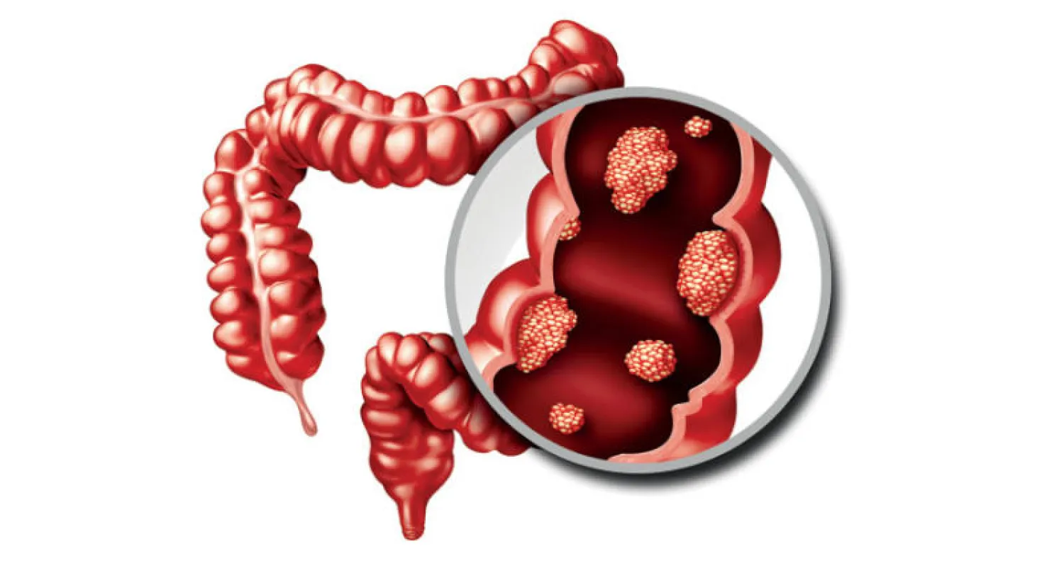 بين الخطأ والصواب