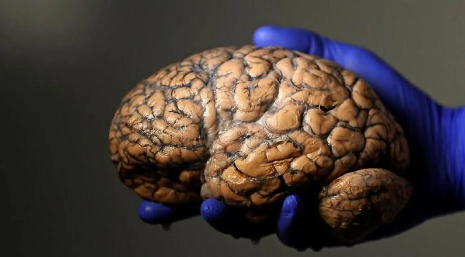 العمل لفترات طويلة يزيد احتمالية التعرض للسكتة الدماغية