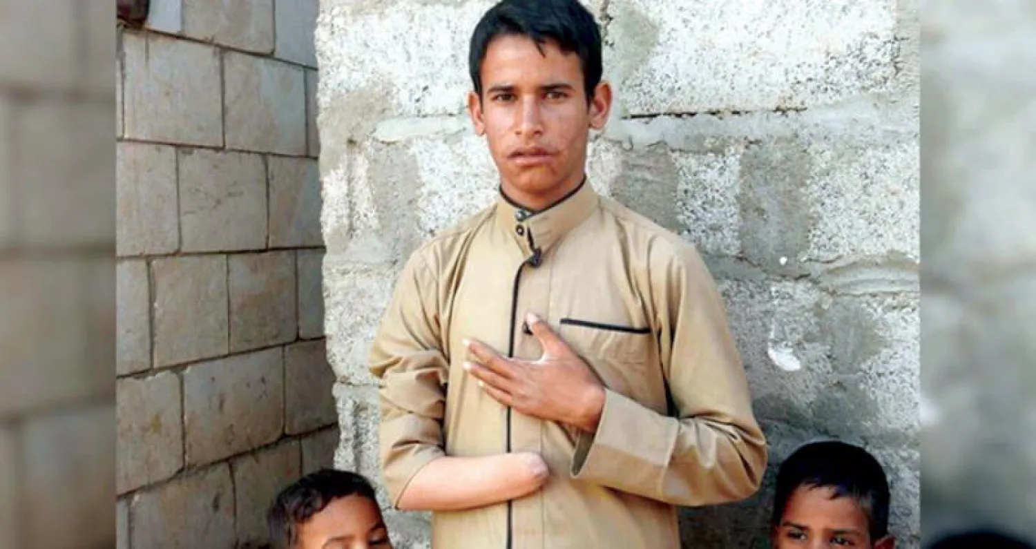 يمني فقد يده إثر انفجار لغم حوثي (مسام)