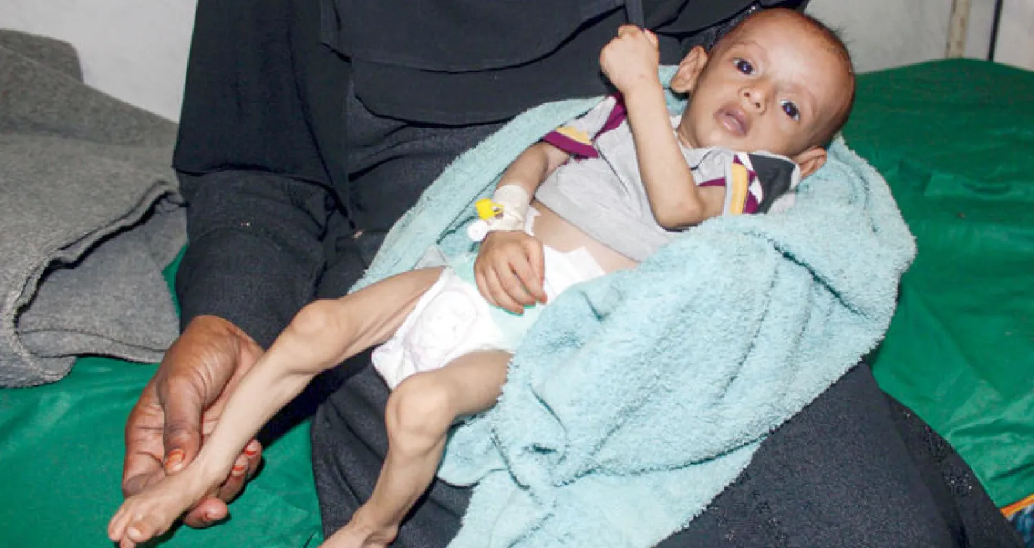 يمنية تمسك بطفلتها التي تتلقى العلاج في مستشفى بالحديدة (أ.ف.ب)