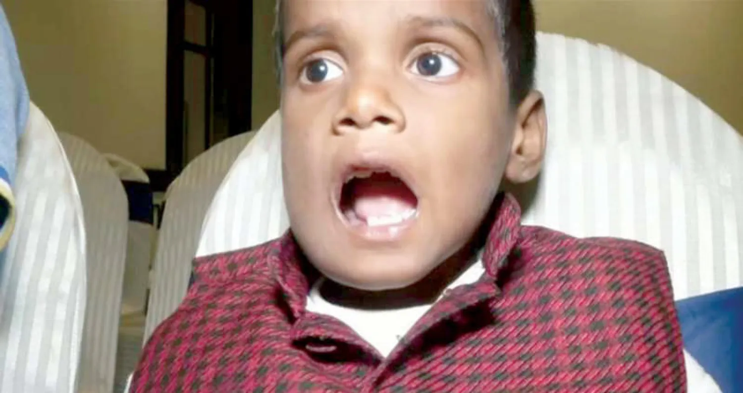 الطفل بعد العملية (رويترز)