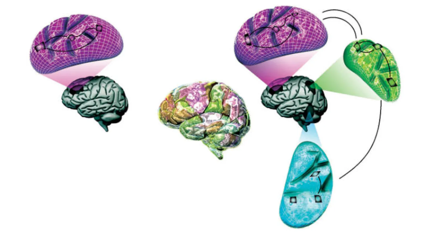 باحثو «كاوست» يطورون مخططاً حسابياً لوظيفة الدماغ لتكوين صورة أكثر وضوحاً