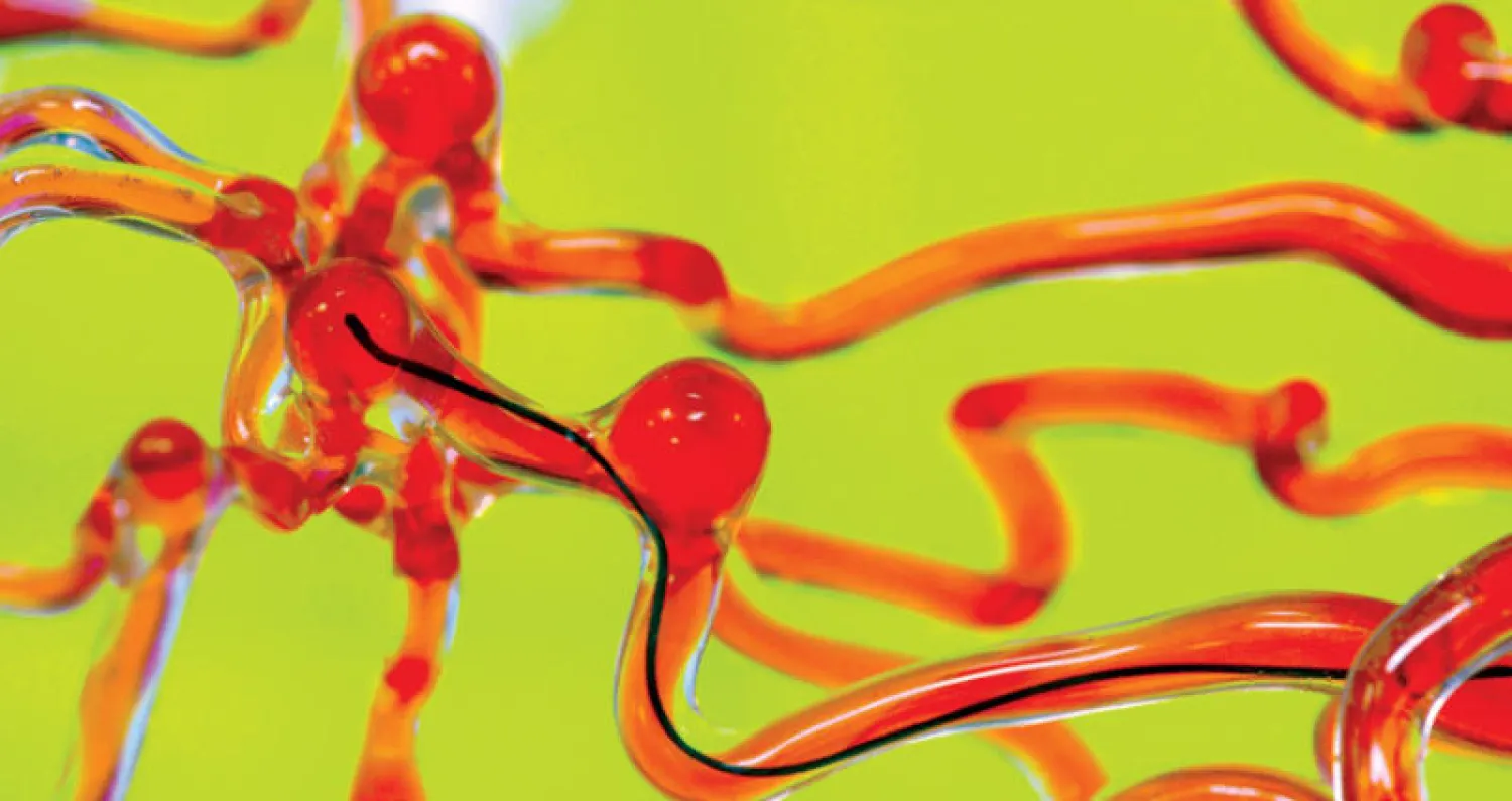 الخيط الروبوتي داخل الأوعية الدموية