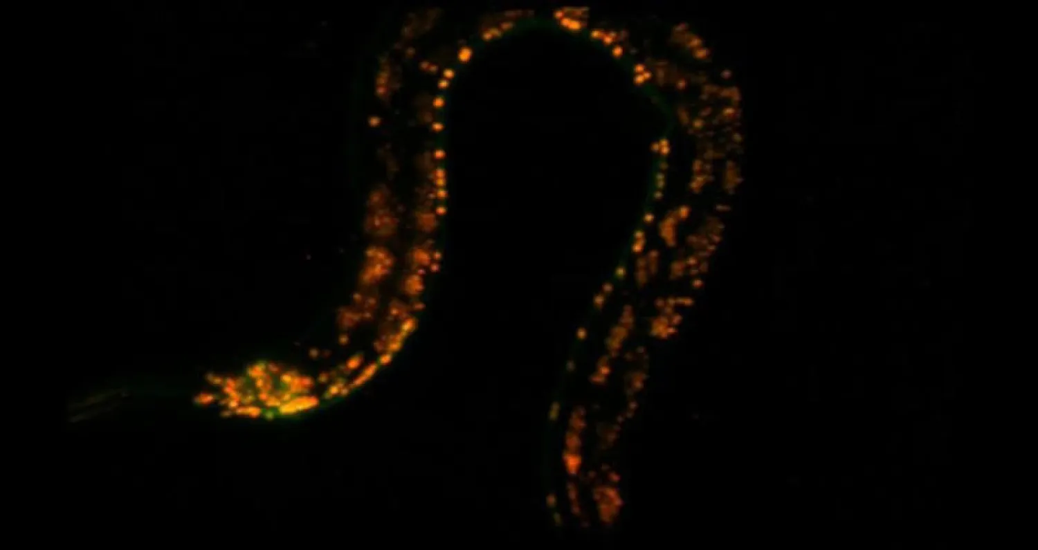 المجهر كشف تفاصيل دودة «الربداء الرشيق» (جامعة كولومبيا)