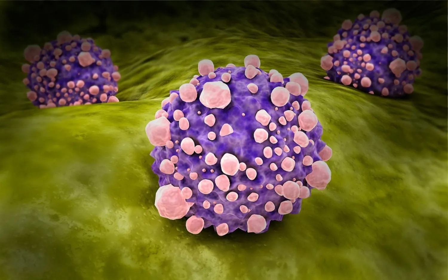 Microscopic view of pancreatic cancer cells. (Getty Images)