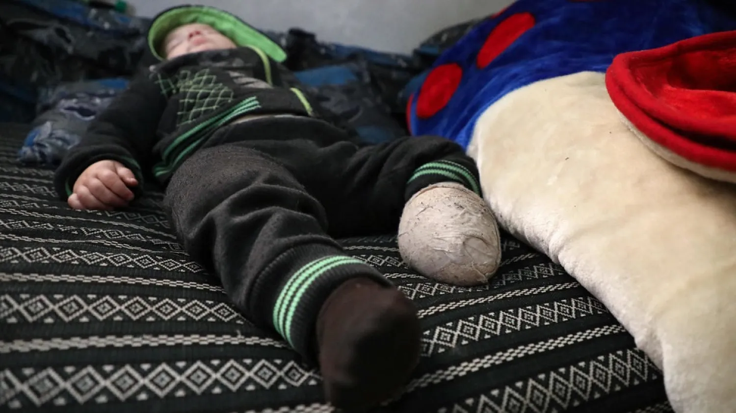 Ismail al-Asali's one-year-old son lost a leg in a missile strike that killed his wife, brother and nephew. (AFP)
