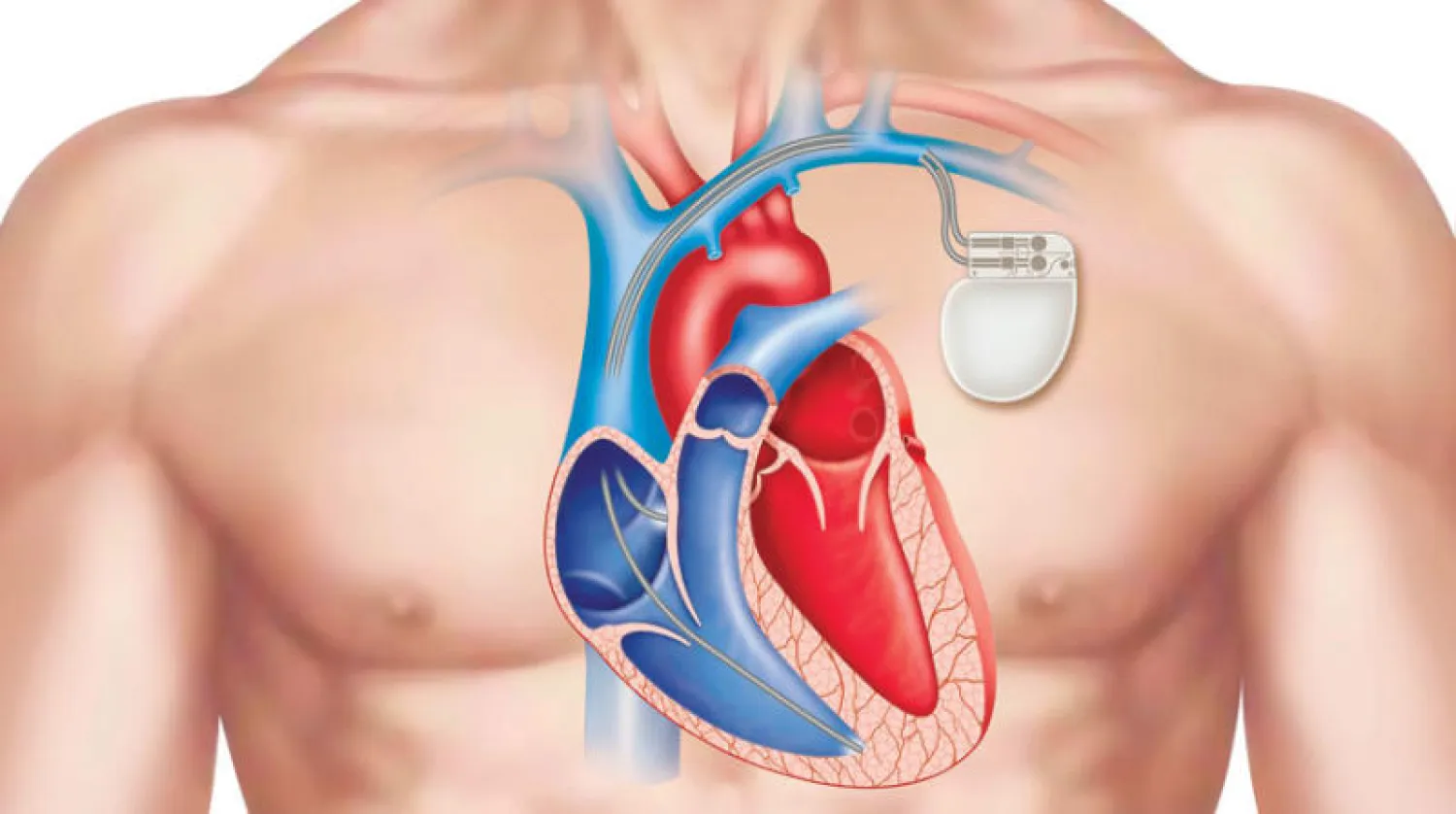 بطء القلب... حالة طبية تستوجب الاهتمام