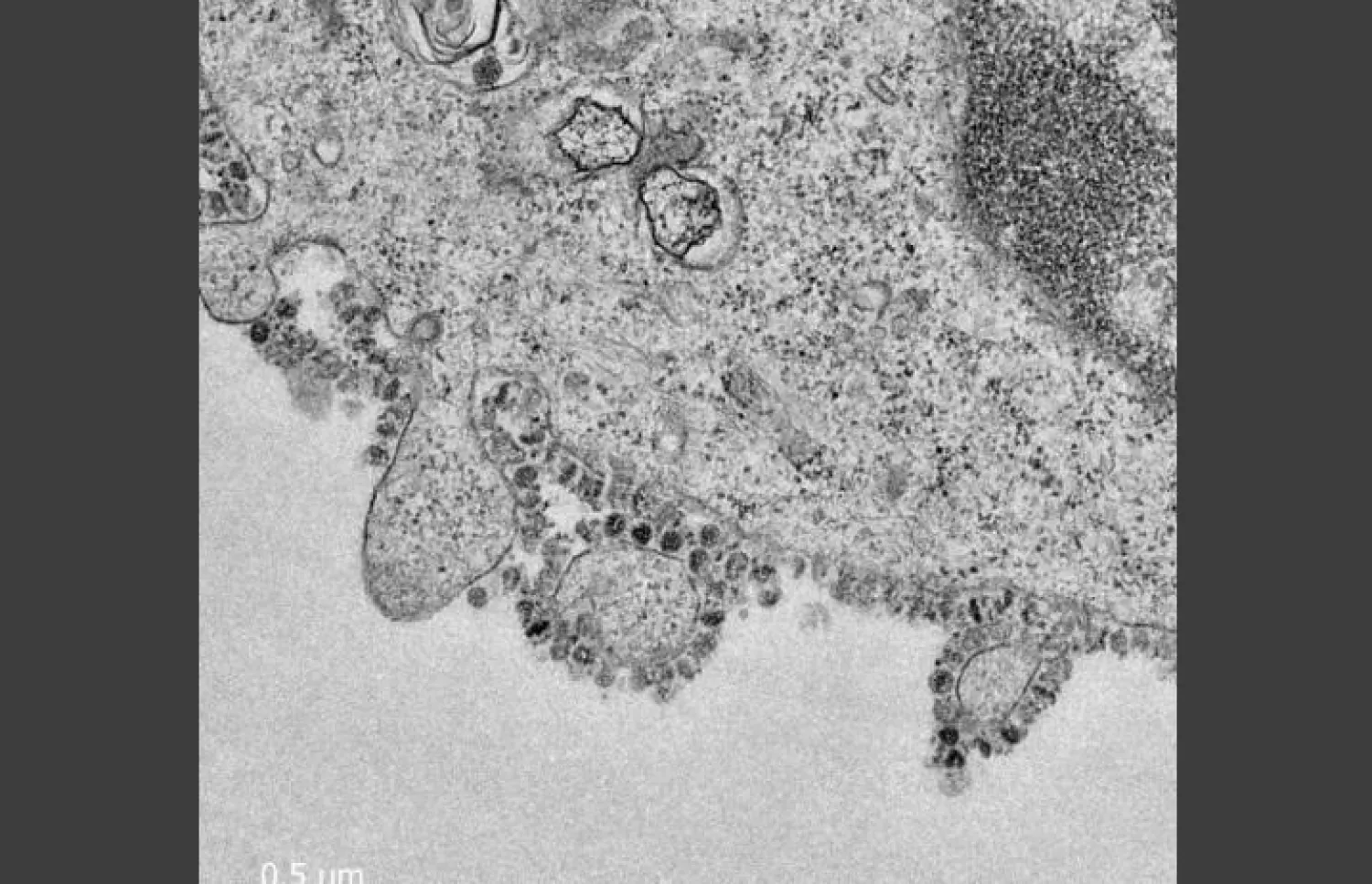 صورة مجهرية لفيروس كورونا الجديد ينمو في خلايا ضمن دراسة بجامعة هونغ كونغ (بلومبرغ)