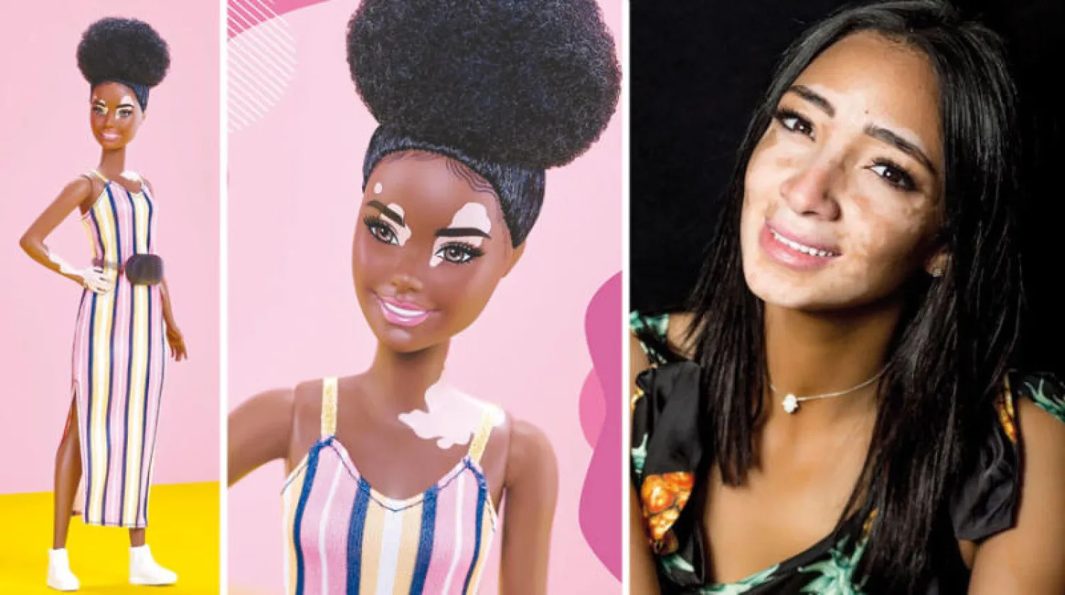 لُجينة صلاح  -  باربي بالبهاق  -  إصدارات جديدة من الباربي بالبهاق