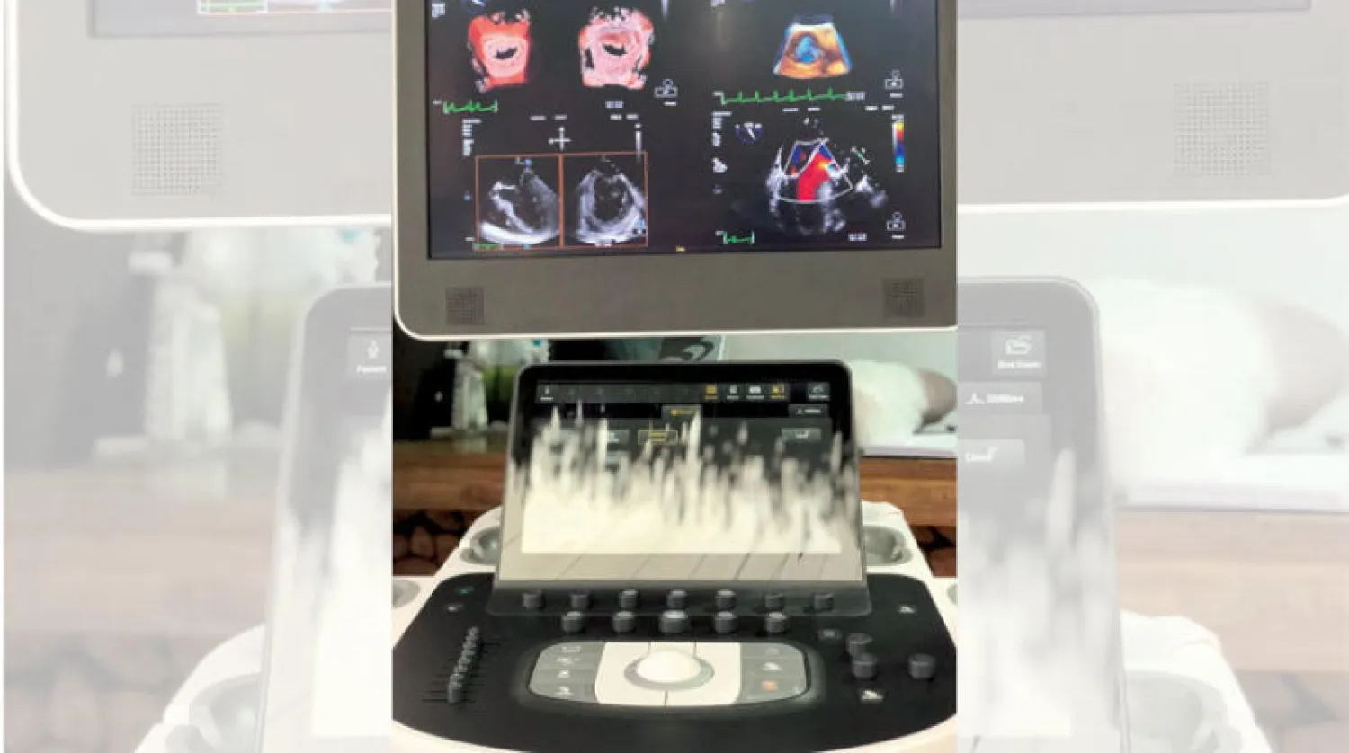 تقنية «إيكو» للتشخيص بالموجات فوق الصوتية