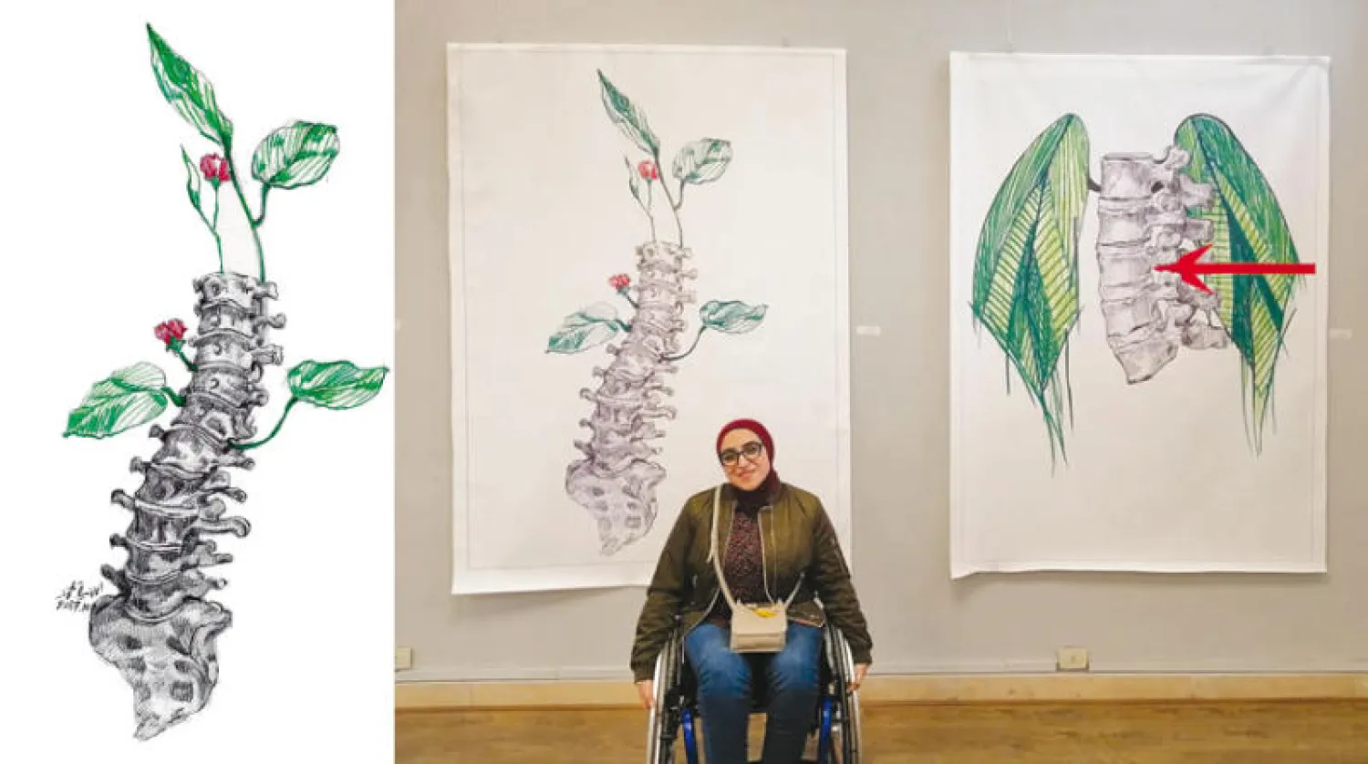 أمنية محمد سيد بين لوحتين تحاكيان العمود الفقري فنياً (الشرق الأوسط)  -  لوحة العمود الفقري أول عمل رسمته بعد الحادث (الشرق الأوسط)