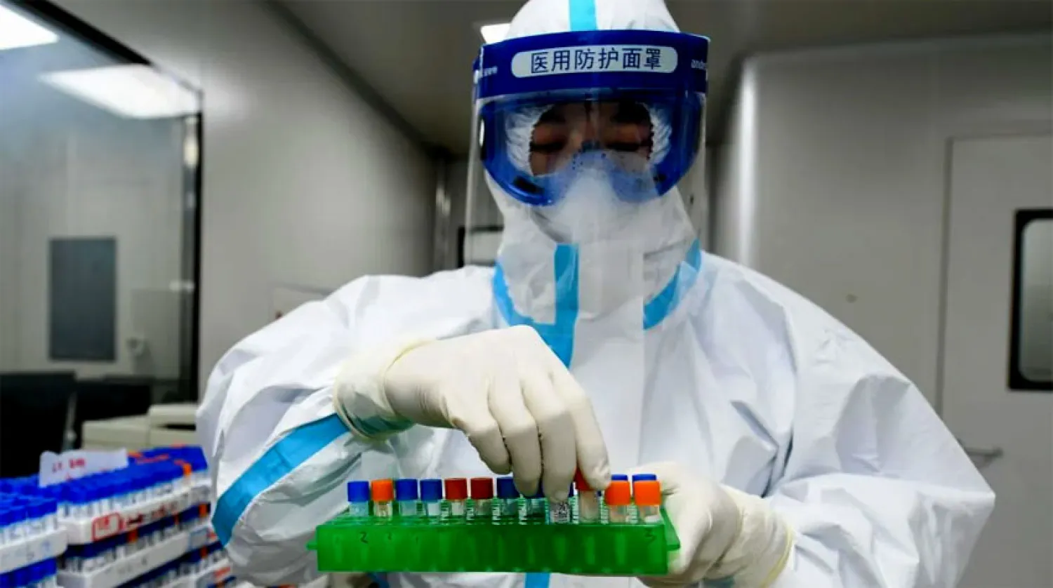 نحو 30 مركزاً في الولايات المتحدة يتسابقون مع الزمن للتوصل إلى لقاح للفيروس