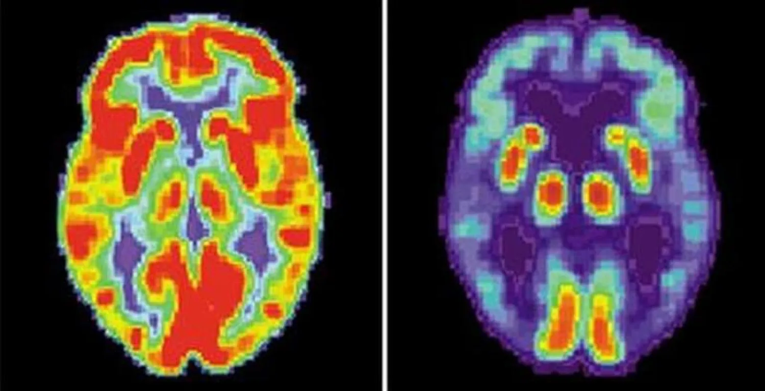 قياس نشاط المخ هو أساس النظام المطوّر (أرشيفية - رويترز)