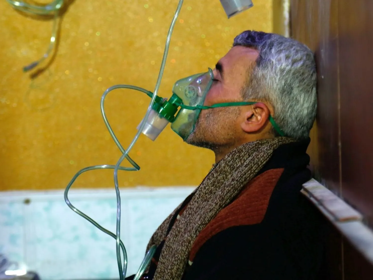 A Syrian man wears an oxygen mask at a make-shift hospital following a reported gas attack on Douma in the eastern Ghouta region on the outskirts of Damascus on January 22, 2018. (Reuters)