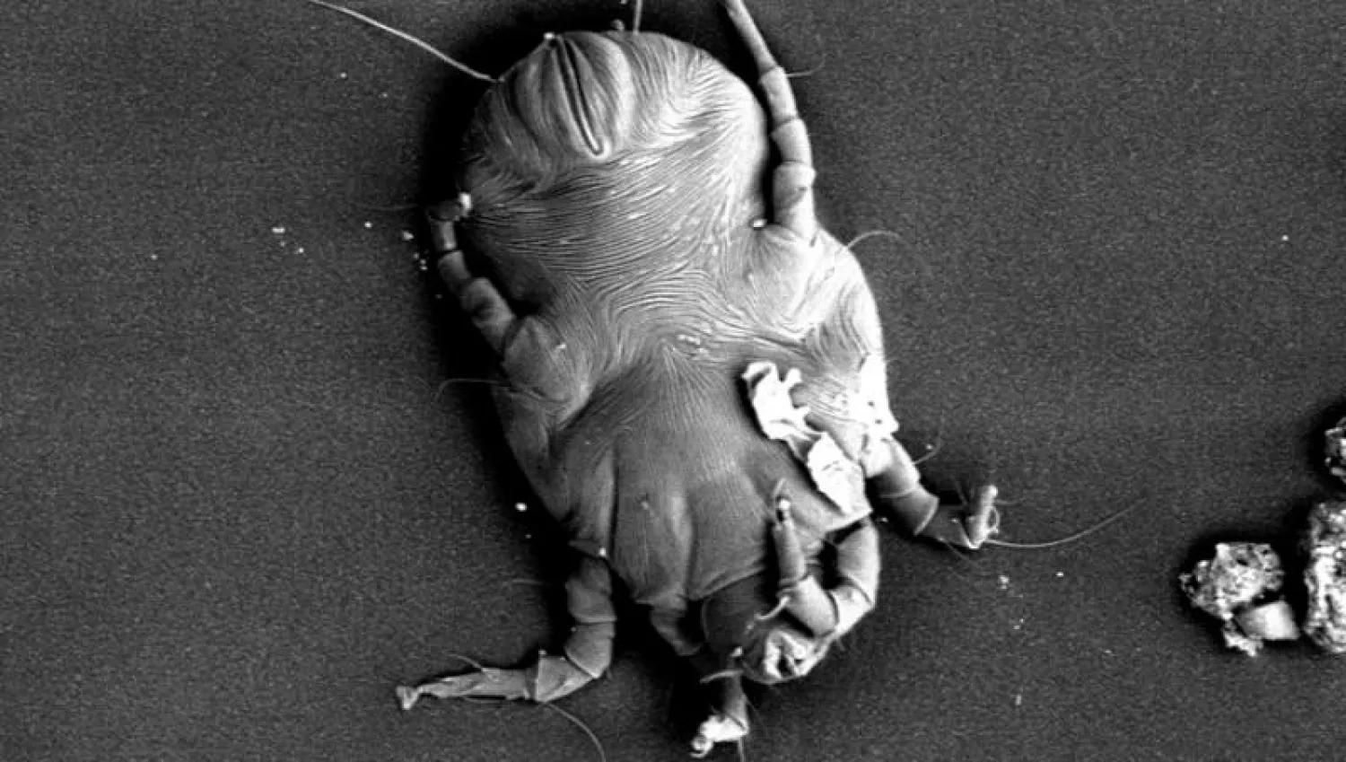 في اليوم العالمي للربو... الغبار المنزلي وآلية التخلص منه