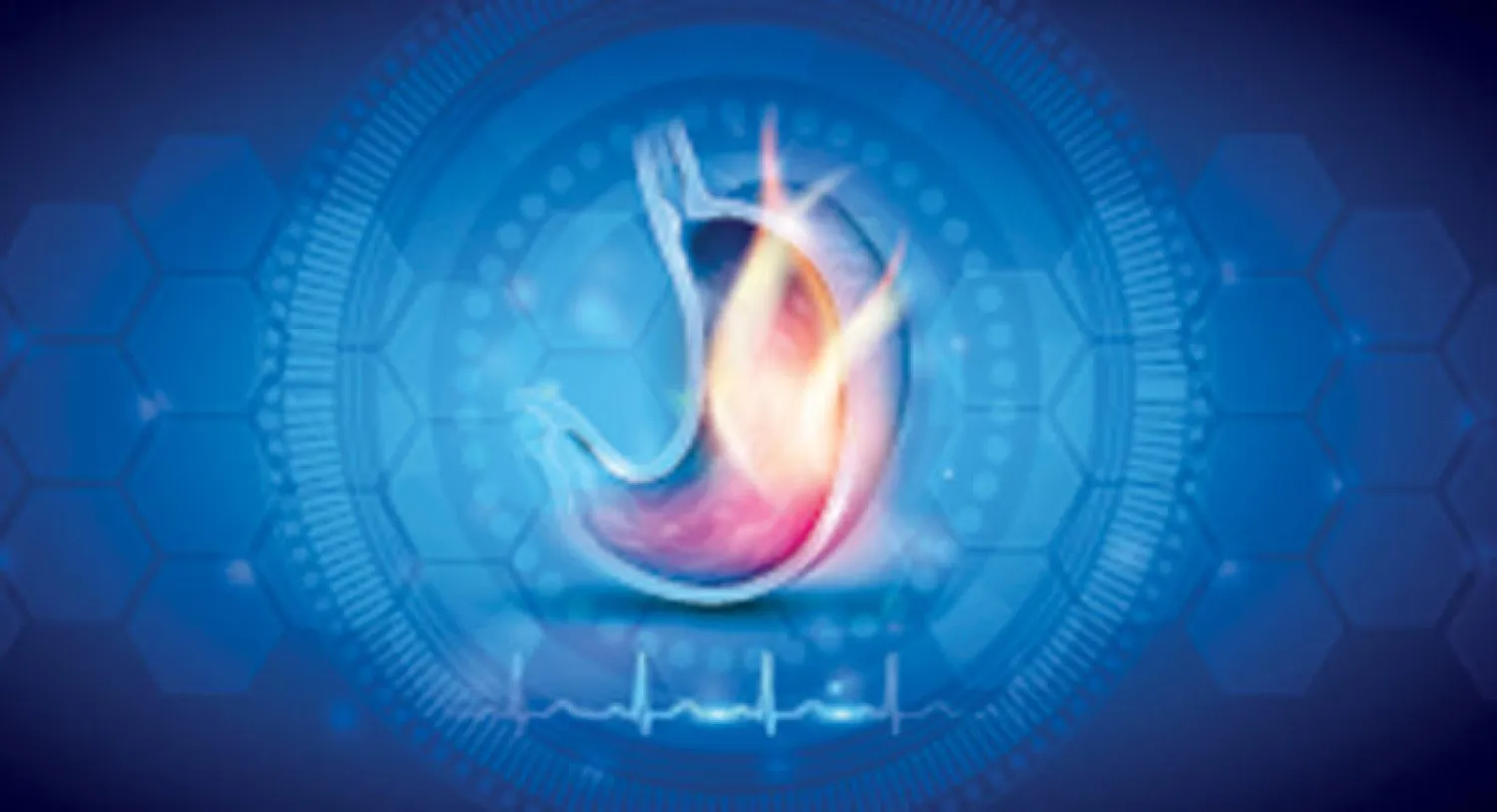 تطوّرات جديدة تثير تساؤلات حول أدوية «حرقة المعدة»