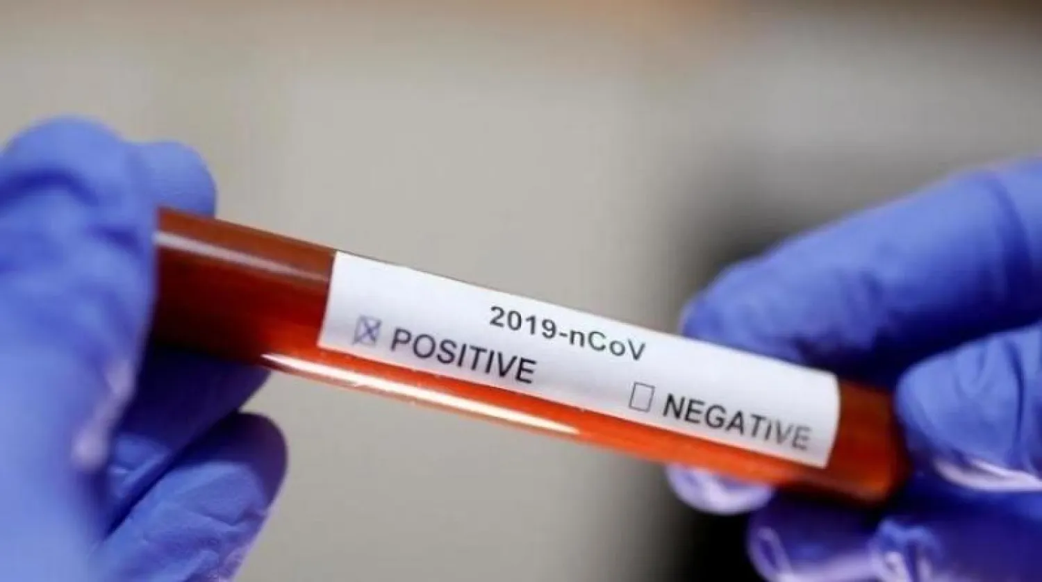 أنبوب اختبار لكشف الإصابات المحتملة بفيروس كورونا المستجد (أرشيفية - رويترز)