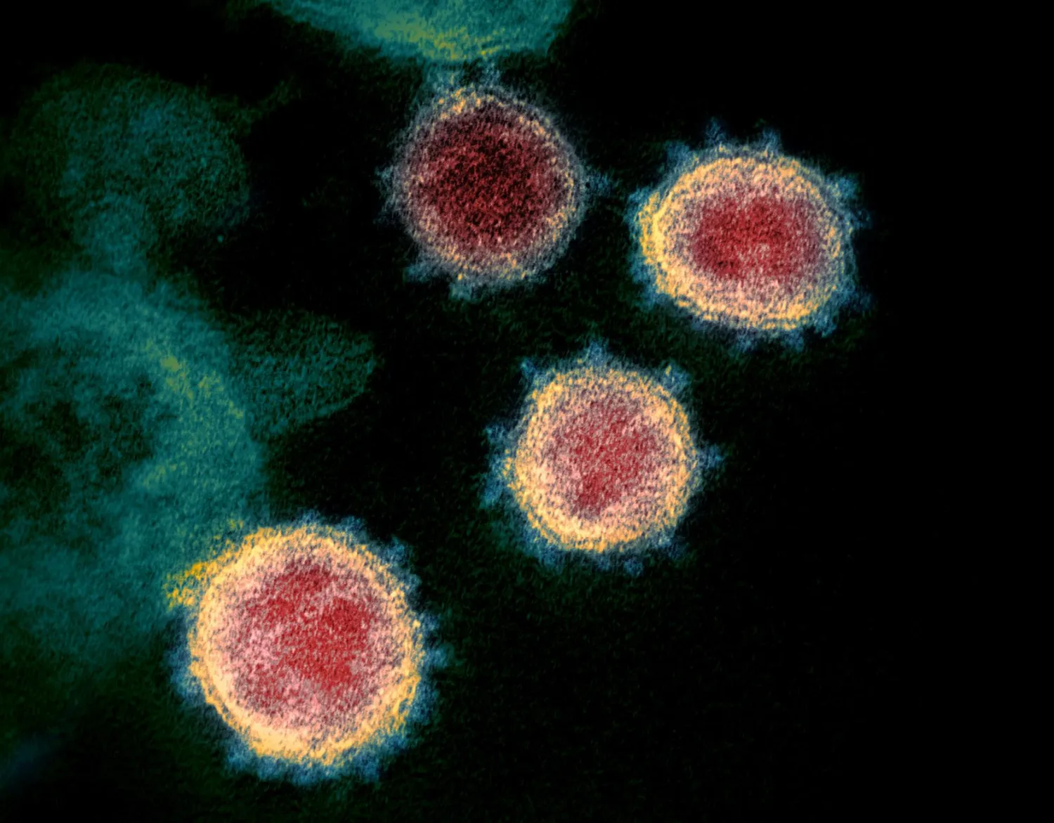 This undated transmission electron microscope image shows SARS-CoV-2, also known as novel coronavirus, the virus that causes COVID-19, isolated from a patient in the US. NIAID-RML/Handout via REUTERS