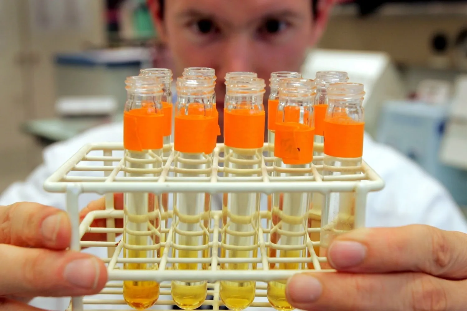 Urine samples are prepared for testing in a Swiss laboratory. Photo: AP