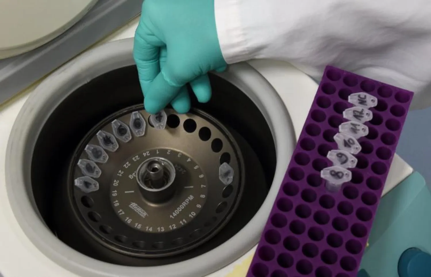 الخبير الفرنسي يري احتمال التوصل إلى لقاح فعّال لـ«كوفيد - 19» بنسبة مائة في المائة بحلول عام 2021 لا يزال ضئيلاً (أ.ف.ب)