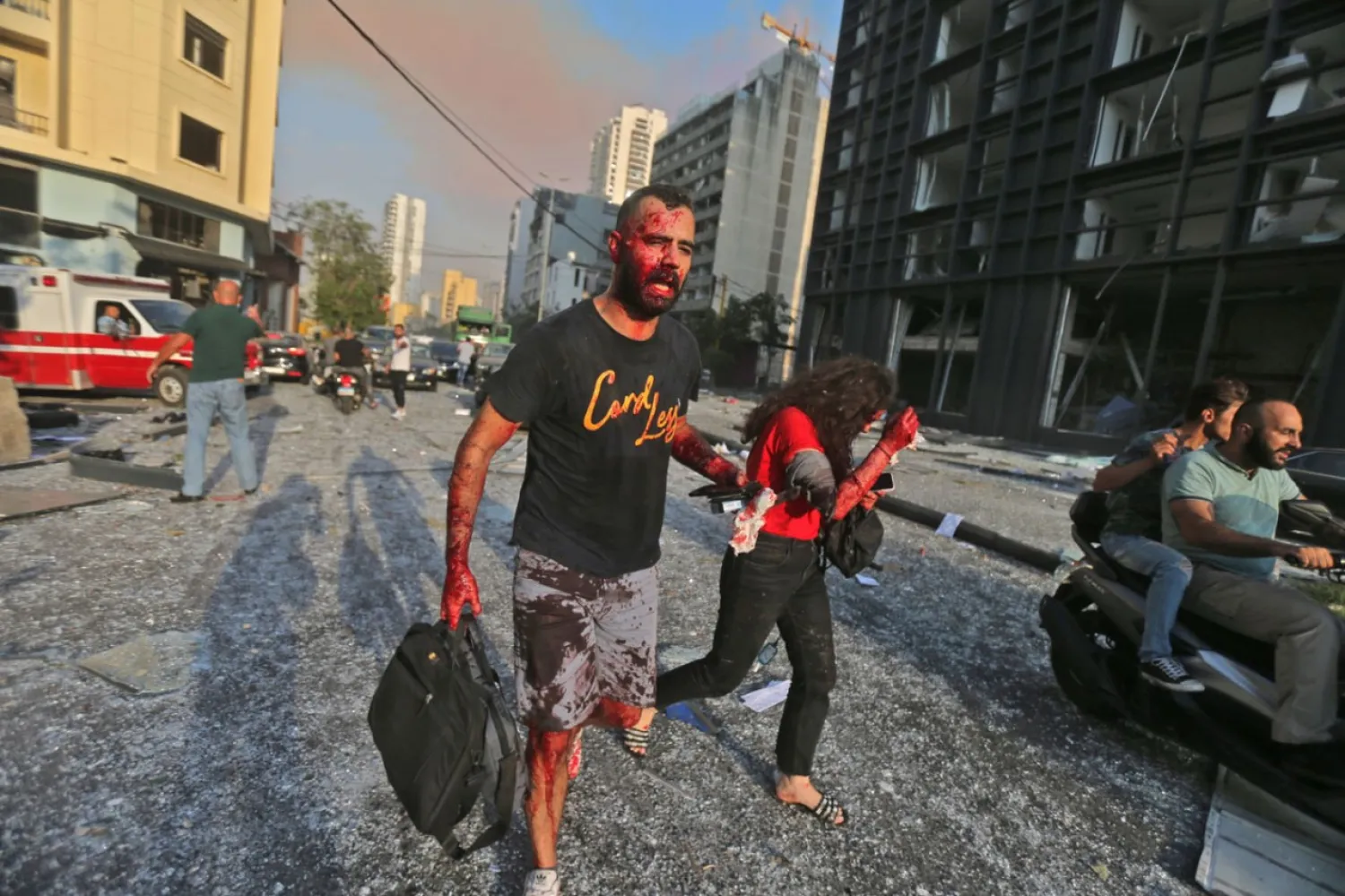 Wounded people walk near the site of an explosion at the port in the Lebanese capital Beirut on August 4, 2020. AFP