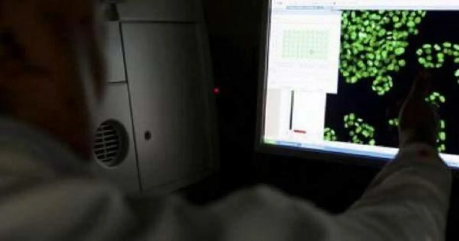 باحثون صينيون يطورون تشخيصا لسرطان المبيض