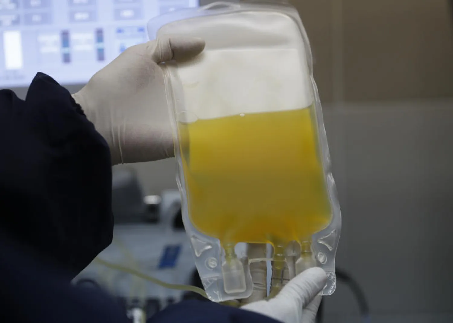 بلازما لمعالجة مريض بـ«كوفيد-19» في العاصمة البوليفة لاباز (أ.ب)